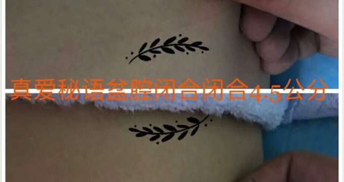 albumimg