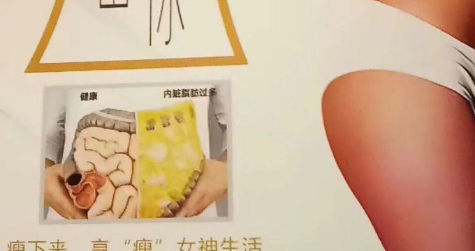 albumimg
