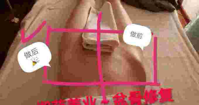 albumimg
