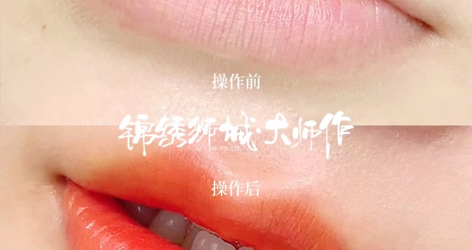 albumimg