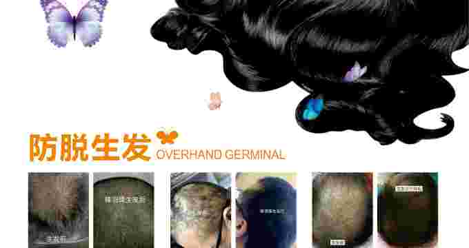 albumimg